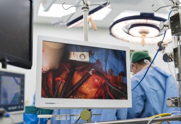 Video monitor showing heart surgery; surgical staff in background